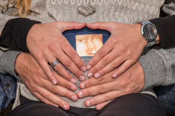 The Best Time to Schedule Your HD Ultrasound During Pregnancy